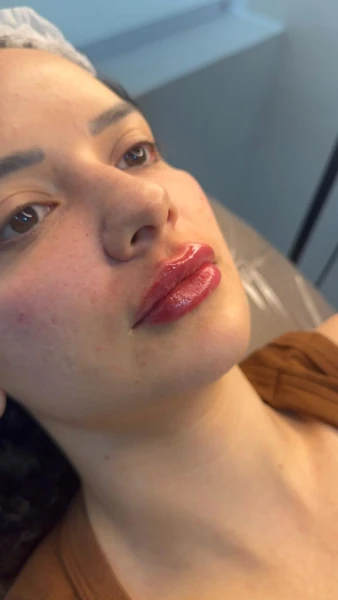 Detalhe estética
